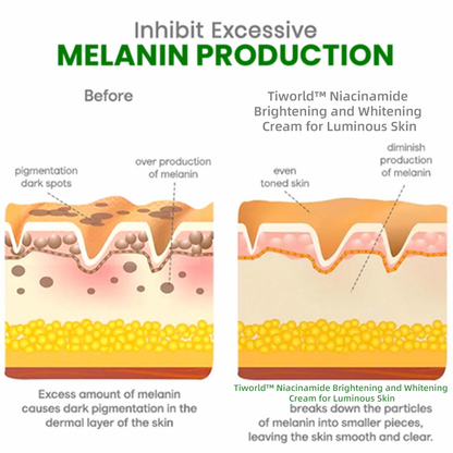 Tiworld™ Crema schiarente e illuminante alla niacinamide per una pelle luminosa ⏰ LA VENDITA TERMINA TRA 10 MINUTI ⏰ 