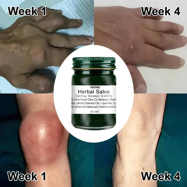 SEAGRIL™&Oslash;kologisk-Comfrey Herbal Salve